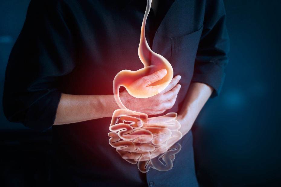 Eu preciso SEMPRE fazer uma CIRURGIA para o REFLUXO gastroesofágico?